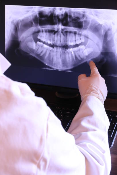 Best Mobile Emergency Dentist in Bonita, CA